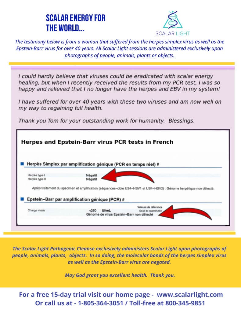 Epstein Barr Virus PCR test