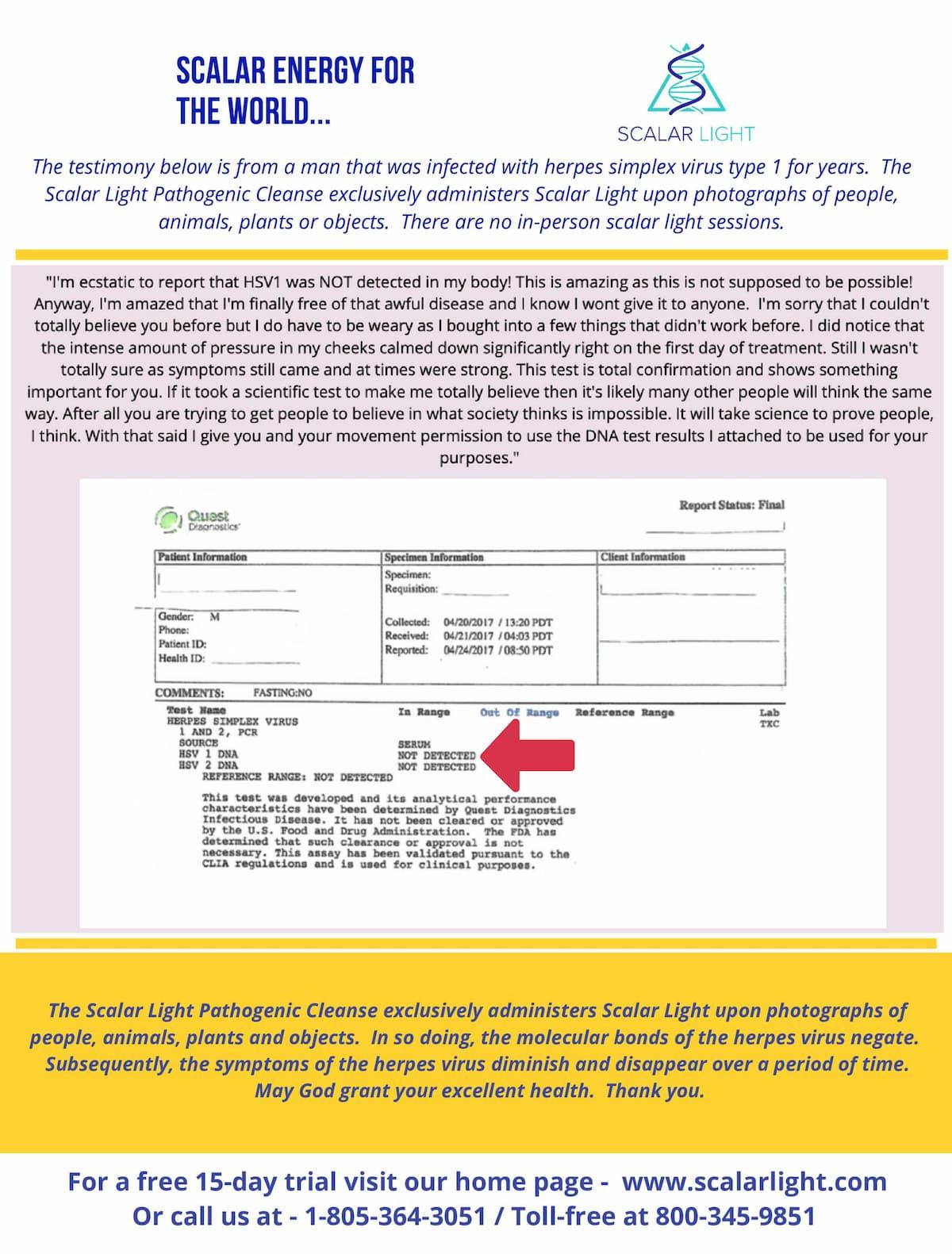 Herpes PCR Test Result