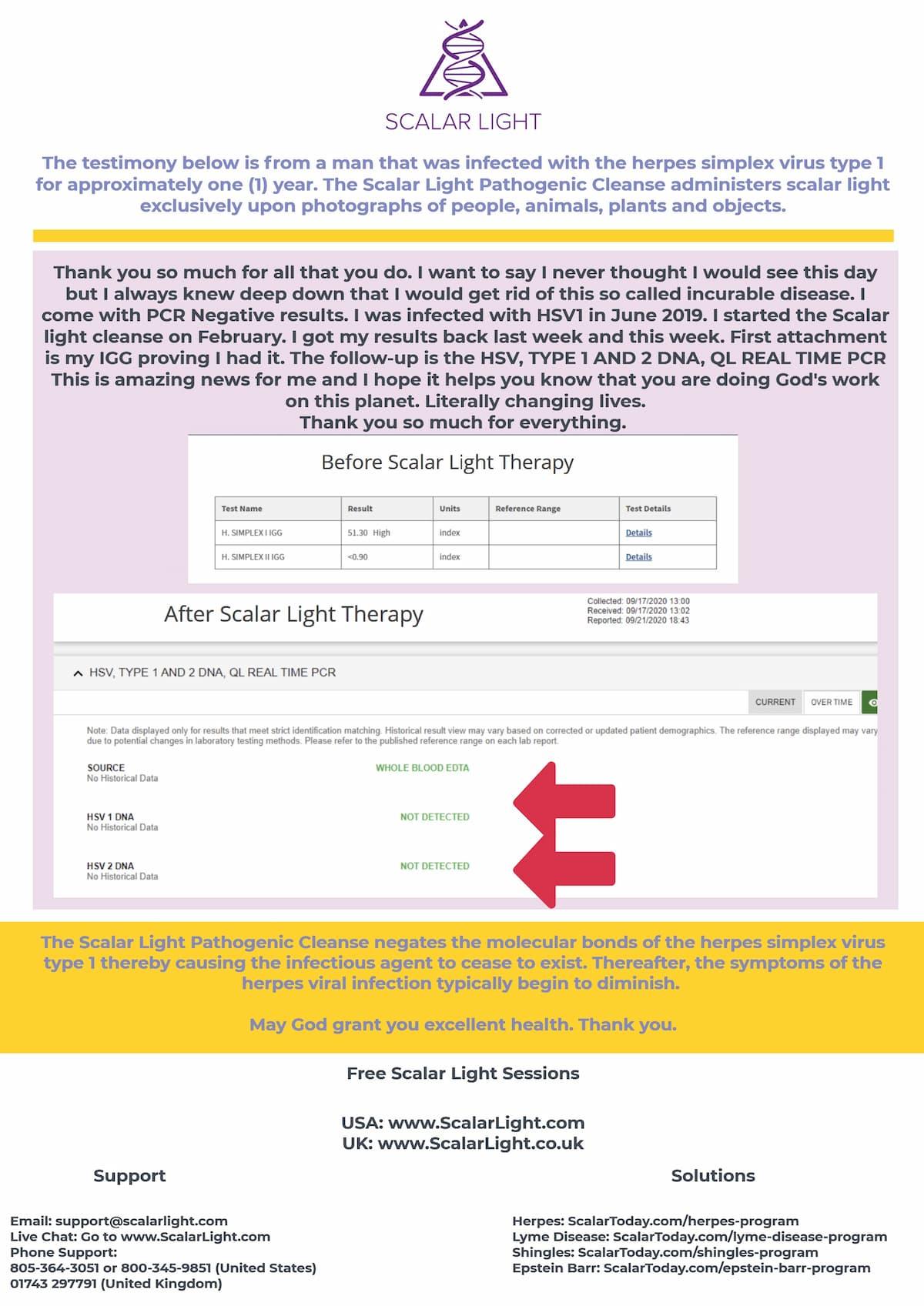 Herpes PCR Test Result